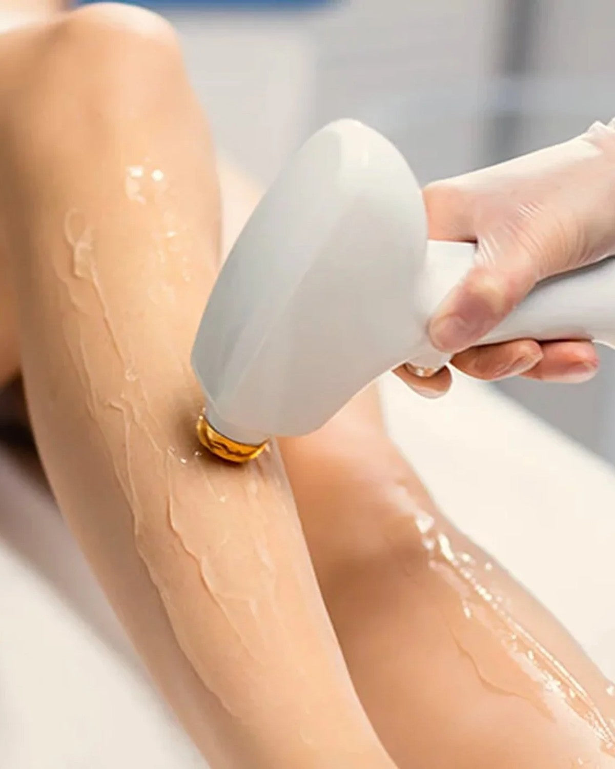 Diode laser handpiece gliding over smooth legs during a laser hair removal session at Luxe Elegance Beauty Center